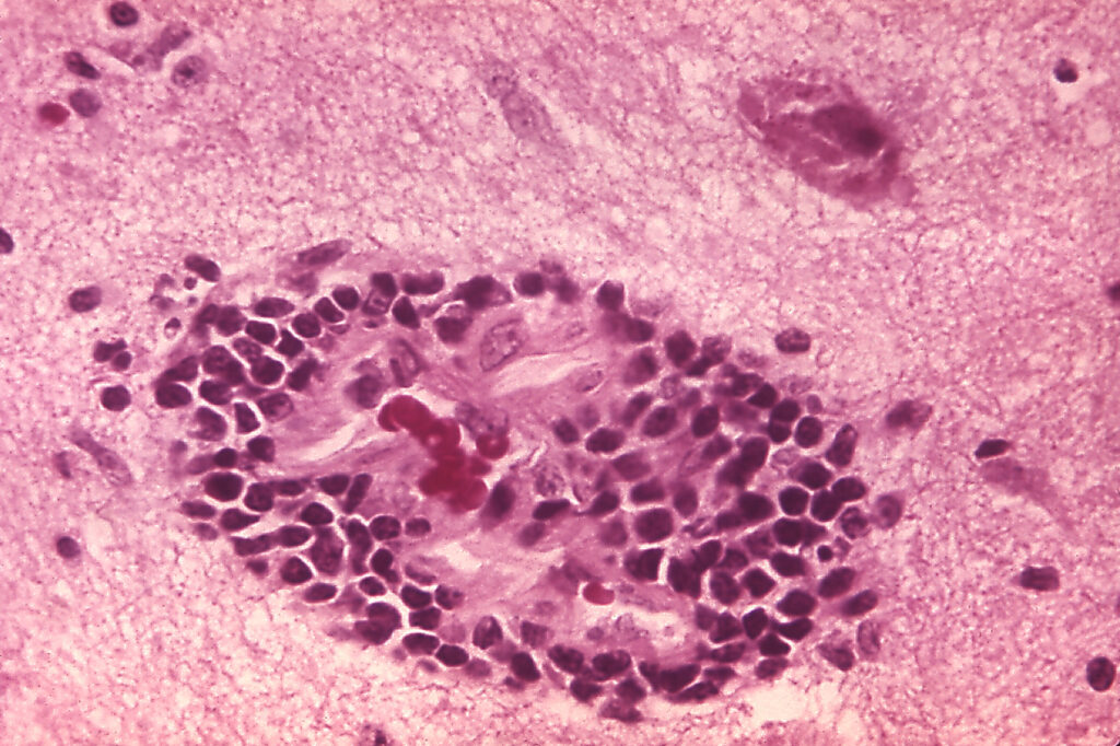 Affected cells by rabies.